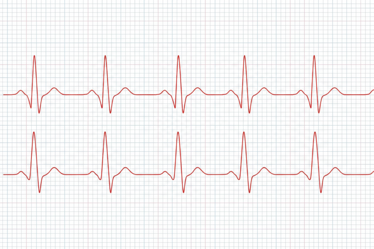 Dog Heart & Cardiology